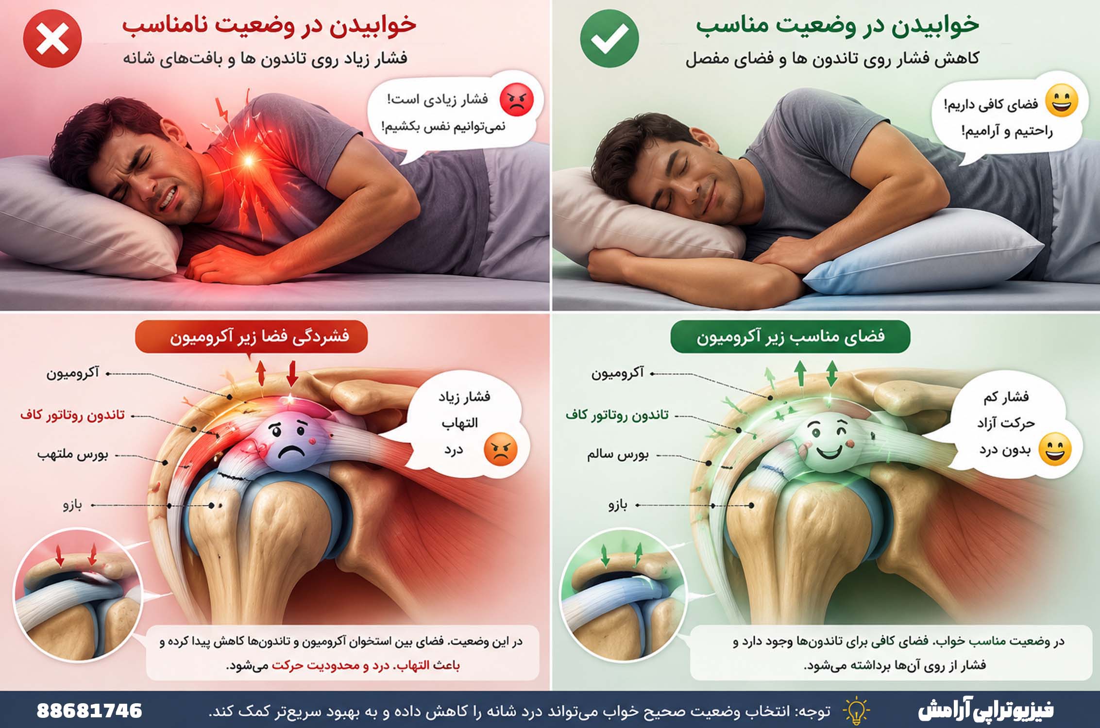 بهترین وضعیت خواب برای درد شانه
